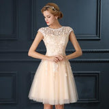 2018 gery collar Lace Up Dress